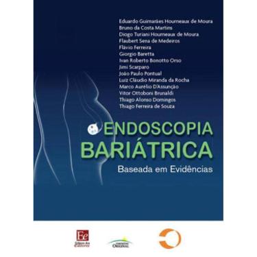 Imagem de Endoscopia Bariátrica