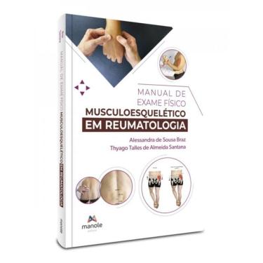 Imagem de Manual De Exame Físico Musculoesquelético Em Reumatologia