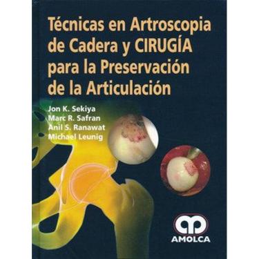 Imagem de Tecnicas En Artroscopia De Cadera