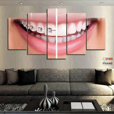 Imagem de Quadro Decorativo Dentista Aparelho 63x130mt com 5 peças