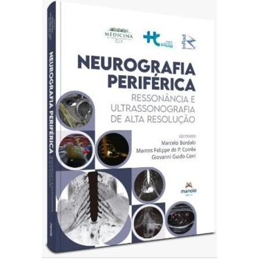 Imagem de Neurografia Periférica: Ressonância e Ultrassonografia de Alta Resolução