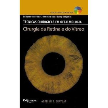 Imagem de Técnicas cirúrgicas em oftalmologia, Cirurgia da Retina e do Vítreo
