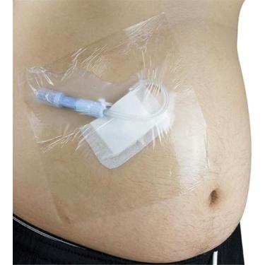Imagem de Barreira De água De Cateter Peritoneal à Prova D'água Para Pacientes De Diálise Peritoneal, Produtos Descartáveis De Cuidados Especiais, 50 pieces