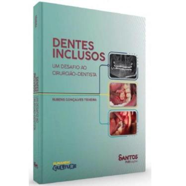 Imagem de Dentes Inclusos: Um  Desafio Para O Cirurgiao Dentista - Santos