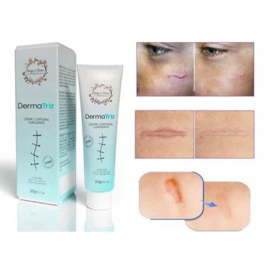 Imagem de Creme E colágeno Para Estrias Cicatriz DermaTriz 20g - Tiarga & Inoue 