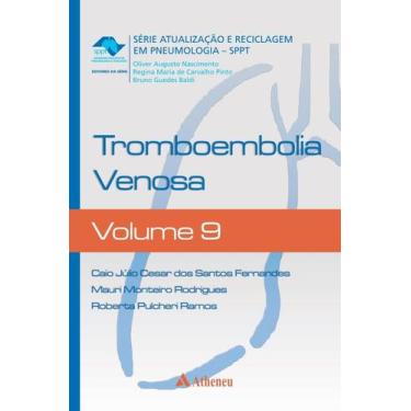 Imagem de Livro - Tromboembolia venosa
