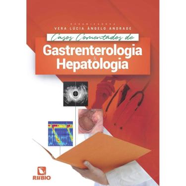 Imagem de Casos Comentados De Gastrenterologia E Hepatologia