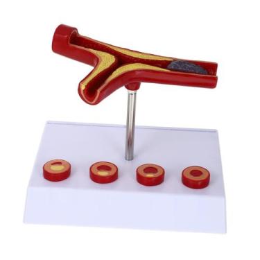 Imagem de Modelo cardiovascular anatômico médico de vasos sanguíneos - FELTECHEL