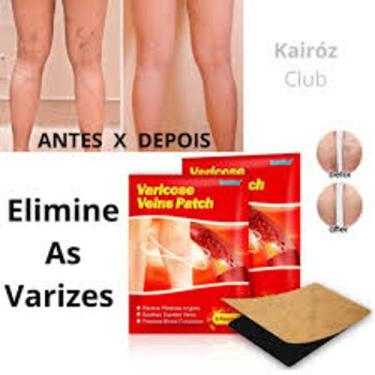 Imagem de Patch para tratamento  de varizes. Com 6 unidades. - Royal