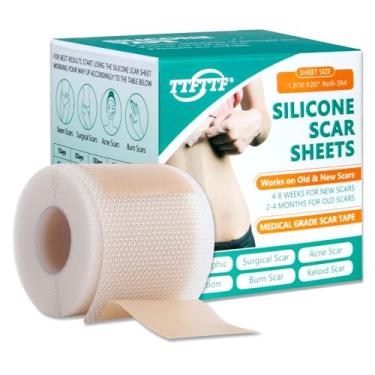 Imagem de Fita de silicone para cicatriz, folhas de silicone para cicatrizes (rolo de 4 x 304 cm), folhas de silicone para cicatrizes faciais, fita de silicone reutilizável de grau médico para cicatrizes