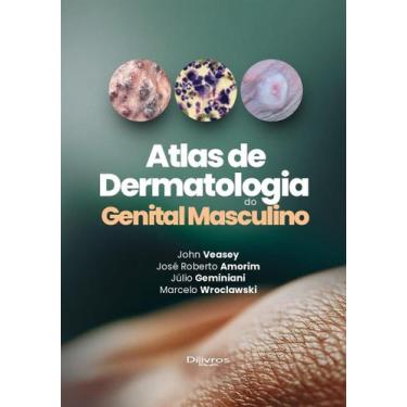 Imagem de Atlas de dermatologia do genital masculino - DI LIVROS EDITORA LTDA