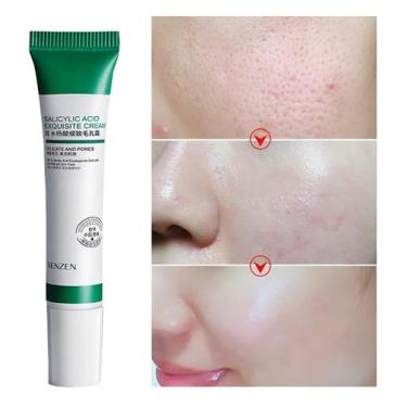 Imagem de Creme De Ácido Salicílico Para Redução De Poros 20ml - sool bom, VERDE