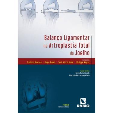 Imagem de Balanco Ligamentar Na Artroplastia Total De Joelho
