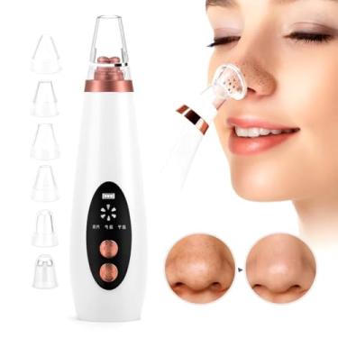 Imagem de Removedor de Cravos Extrator Sugador Espinhas Poros Cleaning Acne a Vácuo Elétrico Aparelho Sucção Dermobrasão Recarregável USB Portátil Peeling Limpeza Facial Aspirador Cuidados Rosto Nariz Máquina Espremedor Tirar Cravos FAZING (Rosa)