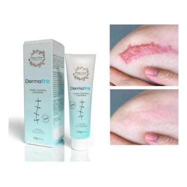 Imagem de Pomada Creme DermaTriz Redutor Estrias E Cicatriz DermaTriz 20g. - Tia