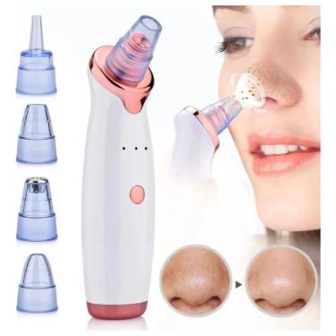 Imagem de Removedor De Cravos Sugador Espinhas Poros Elétrico Peeling - Extrator