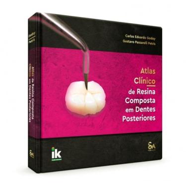 Imagem de Atlas Clínico De Resina Composta Em Dentes Posteriores - Santos Pub