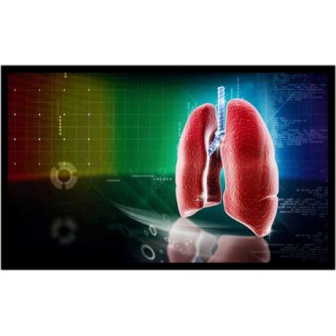 Imagem de Quadro Decorativo Medicina Médicos Pulmão Pneumologia Consultórios Com