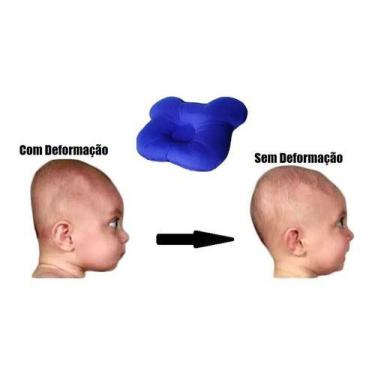 Imagem de Travesseiro Que Evita Cabeça Chata - Plagiocefalia Ursinho - Happy Lin