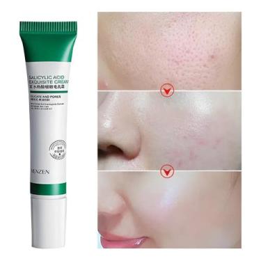 Imagem de Creme De Ácido Salicílico Para Redução De Poros 20ml Todo Tipo De Pele