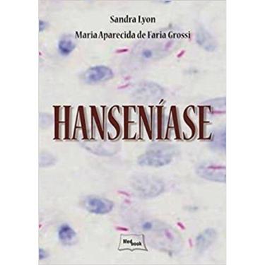 Imagem de Hanseníase Capa dura – Edição padrão, 1 janeiro 2013