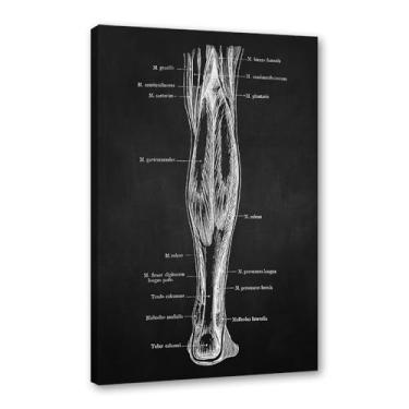 Imagem de Fundo preto anatomia humana arte médica impressões em tela imagens esqueleto músculo pôster vintage educação pintura arte decoração de parede (SKU6,27.9x35.6 cm = (28x35 cm), emoldurado (tela embalada