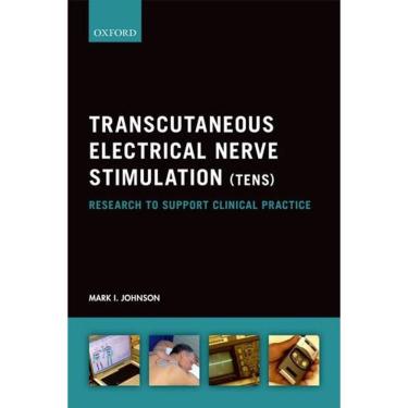 Imagem de Transcutaneous Electrical Nerve Stimulation (tens)