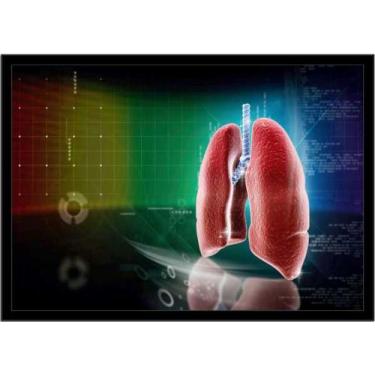Imagem de Quadro Decorativo Medicina Consultórios Pulmão Com Moldura RC061 - Vit