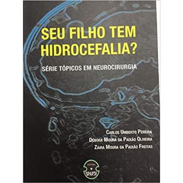 Imagem de Seu Filho Tem Hidrocefalia?
