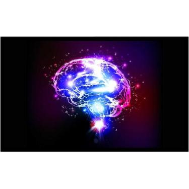 Imagem de Quadro Decorativo Medicina Médicos Cérebro Neurologia Psiquiatria Cons