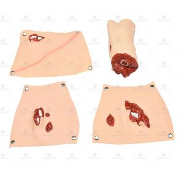 Imagem de Kit Trauma E Feridas Em 16 Peças