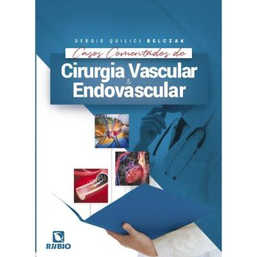 Imagem de Cirurgia Vascular E Endovascular Casos Comentados De