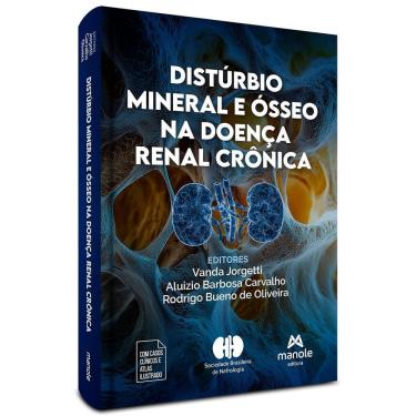 Imagem de Distúrbio Mineral e Ósseo na Doença Renal Crônica