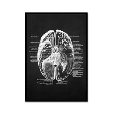 Imagem de Fundo preto anatomia humana arte médica impressões em tela imagens esqueleto músculo pôster vintage educação pintura arte decoração de parede (SKU8,30.5x40.6 cm = (30x40cm), moldura de metal preto)