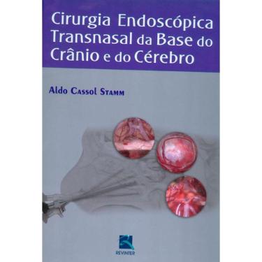 Imagem de Cirurgia Endoscópica Transnasal Da Base Do Crânio E Do Cérebro