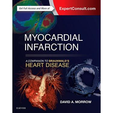 Imagem de Myocardial Infarction: A Companion to Braunwald's Heart Disease