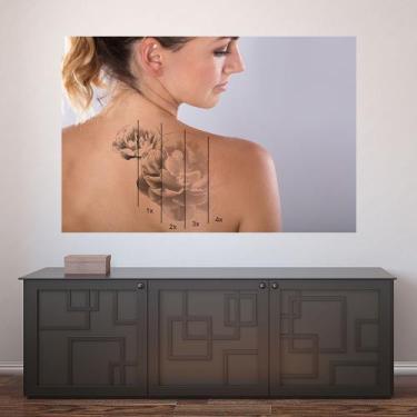 Imagem de Painel Adesivo de Parede - Remoção de Tatuagem - 1199pnp - Allodi