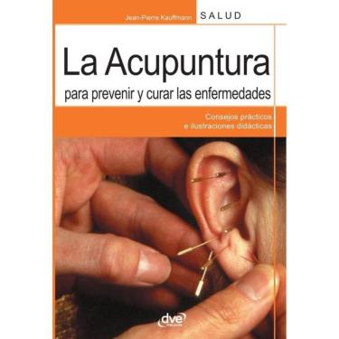 Imagem de La acupuntura para prevenir y curar las enfermedades - Espanhol
