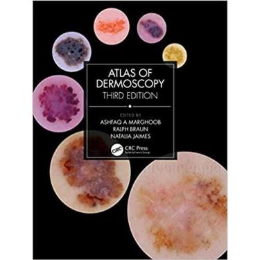 Imagem de Atlas Of Dermoscopy