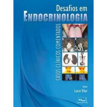 Imagem de Livro - Desafios em endocrinologia