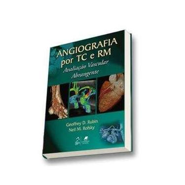 Imagem de Angiografia por tc e rm - avaliacao vascular abrangente