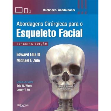 Imagem de Abordagens Cirurgicas Para O Esqueleto Facial