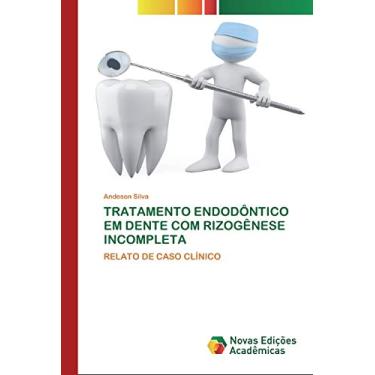Imagem de Tratamento Endodôntico Em Dente Com Rizogênese Incompleta: RELATO DE CASO CLÍNICO