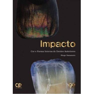 Imagem de Livro Impacto Cor E Forma Interna De Dentes Anteriores - Quintessence