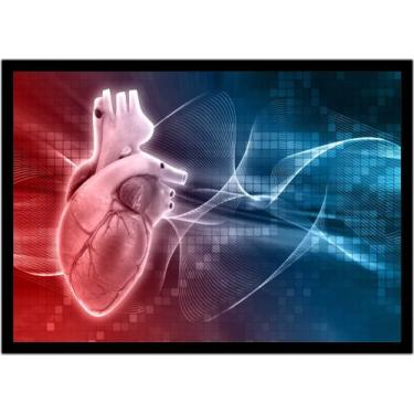 Imagem de Quadro Decorativo Medicina Consultórios Cardiologia Coração Com Moldur