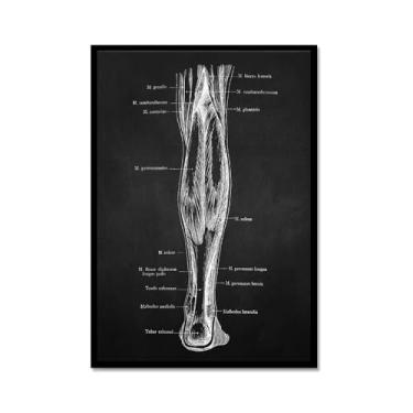 Imagem de Fundo preto anatomia humana arte médica impressões imagens esqueleto músculo pôster vintage educação pintura arte decoração de parede (SKU6,40.6x61.0 cm = (40x60cm), moldura de metal preto)