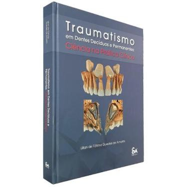 Imagem de Livro Traumatismo Em Dentes Decíduos E Permanentes, 1ª Ed - Santos Pub