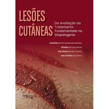 Imagem de Lesões Cutâneas: Da Avaliação Ao Tratamento Fundamentado Na Etiopatoge