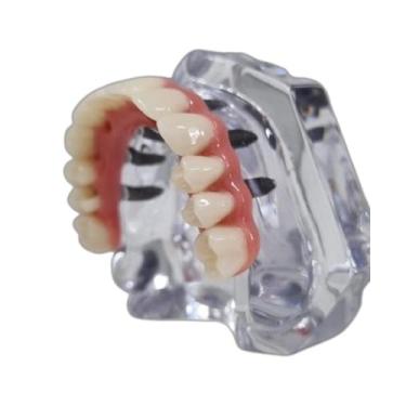 Imagem de Ri-097 d protocolo sup. c/ 6 impls. s/ barra externa fundida - ROIC