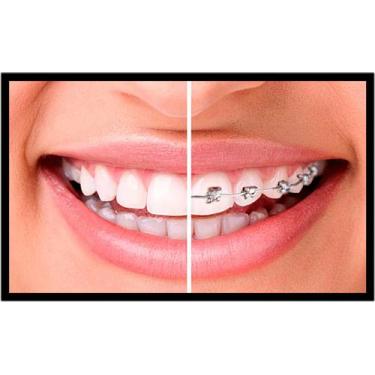 Imagem de Quadro Decorativo Dentista Dentes Odontologia Consultórios Salas Com M